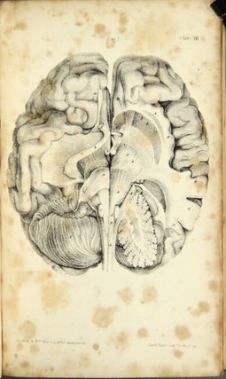 The human brain, its configuration, structure, development, and physiology; illustrated by references to the nervous system in the lower order of animals.