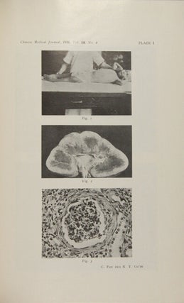 23 medical offprints concerning pathology including disease among the Chinese