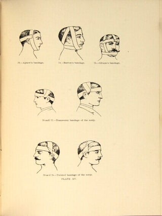The principles and practice of bandaging